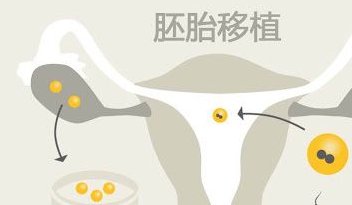 2026年单身去东莞广济医院做一次三代试管要花多少钱？完整费用可参考